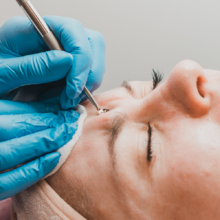 LIMPIEZA FACIAL PROFUNDA